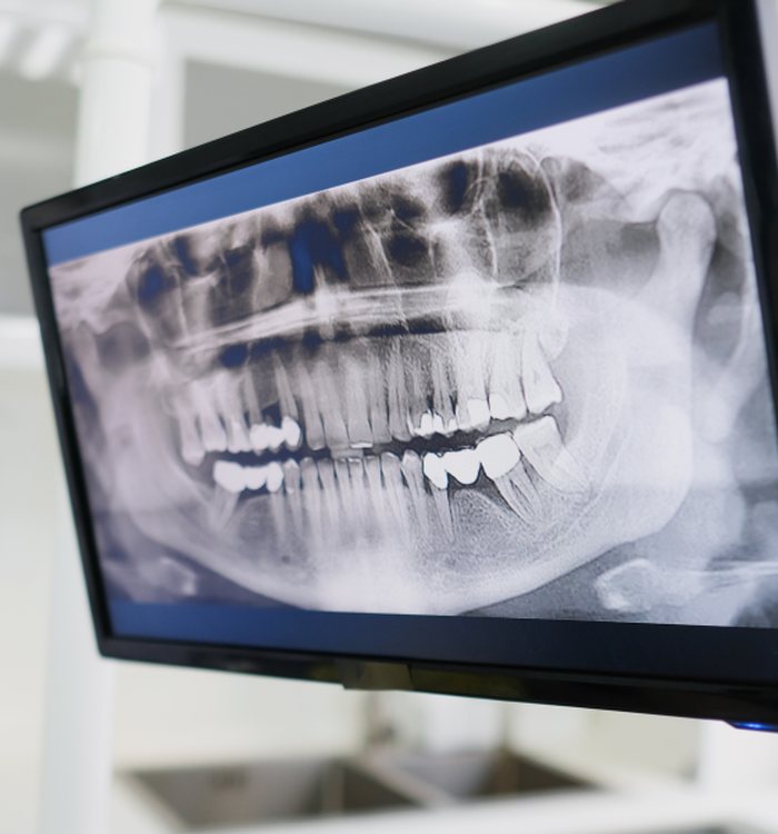 New patient exam and digital X-rays at Century Smile Maker