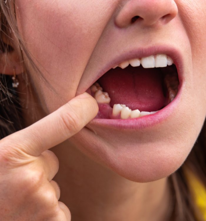 Restorative Dentistry